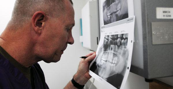 granuloma dentale devitalizzazione