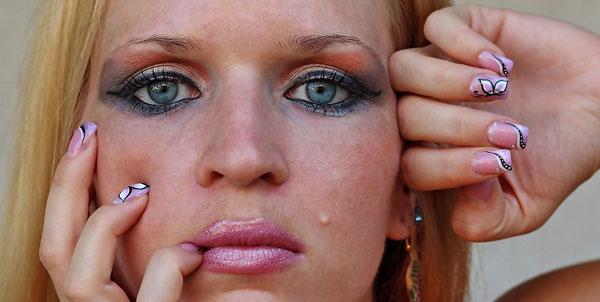 gli antibiotici per acne sono davvero utili